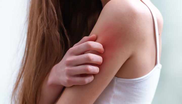 8 foods that may cause itching as an allergic reaction