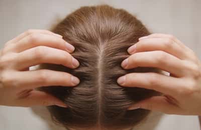 Chute de cheveux féminine : causes, signes et traitements